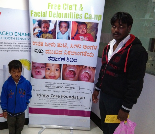 Free cleft lip palate surgery bangalore