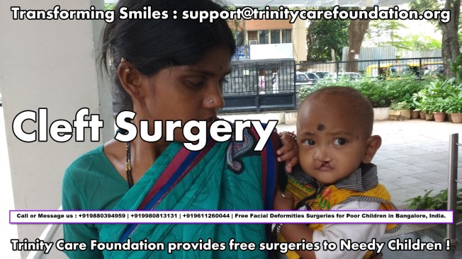 Free Cleft Surgery India
